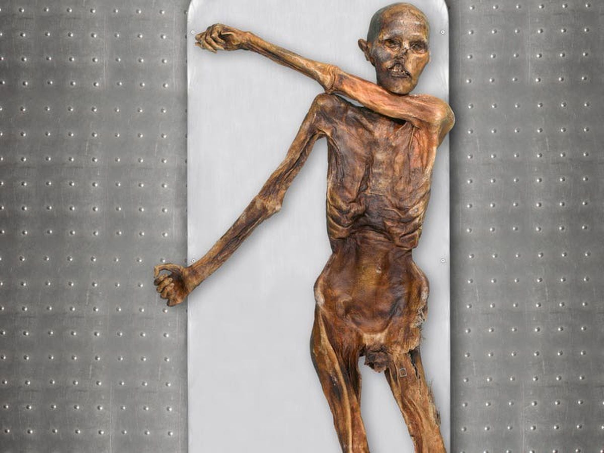 Iceman Otzi Had Dark Skin And Male Pattern Baldness Analysis Reveals