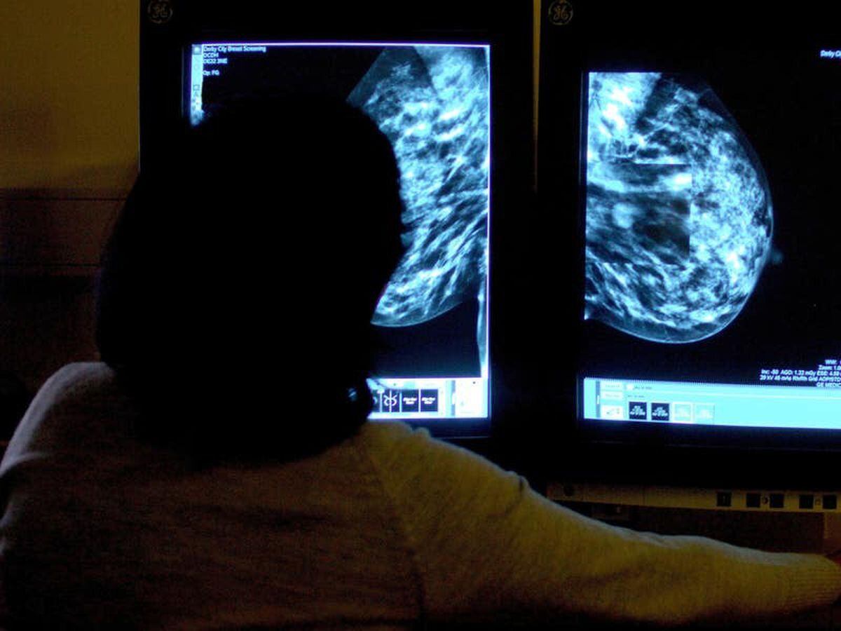 New Breast Cancer Drugs To Benefit Thousands Guernsey Press