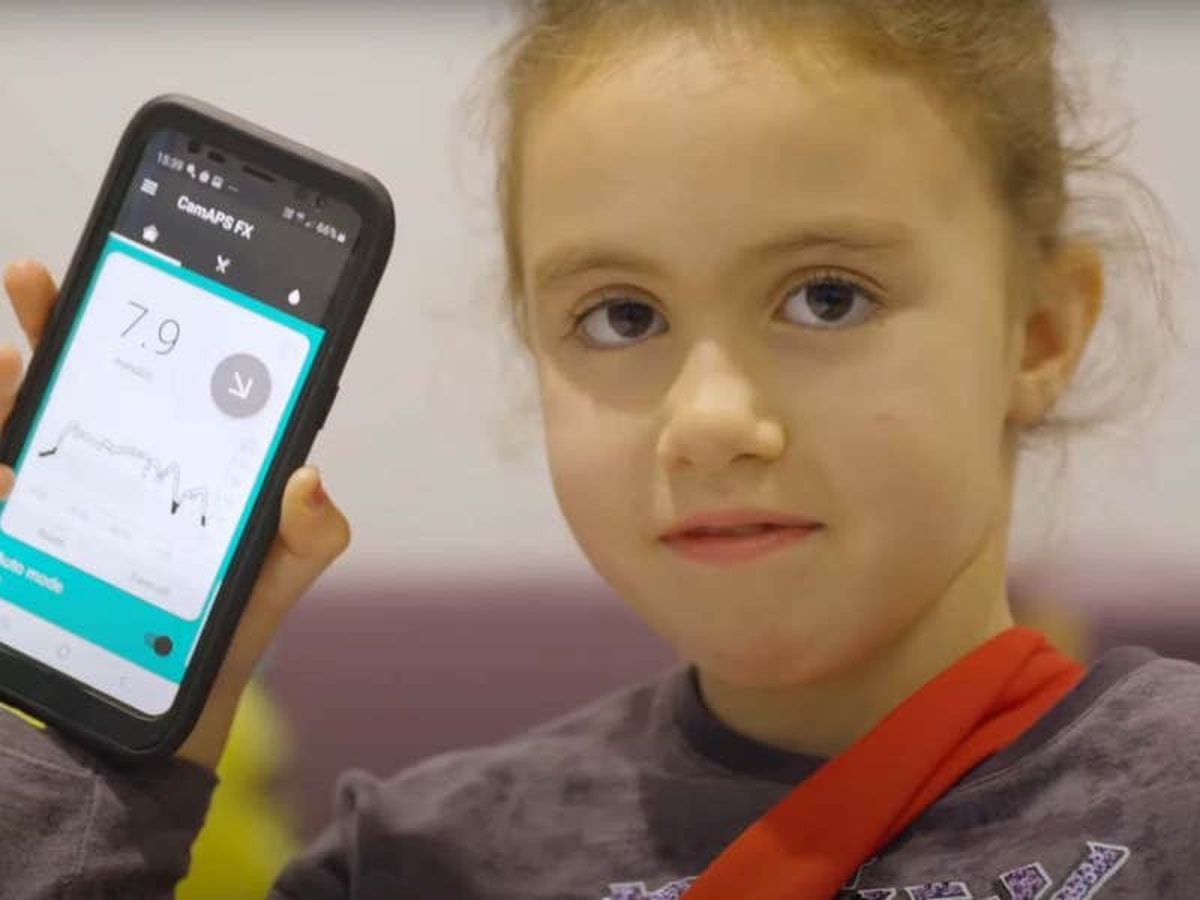 Artificial pancreas is ‘life-changing’ for very young children, experts say