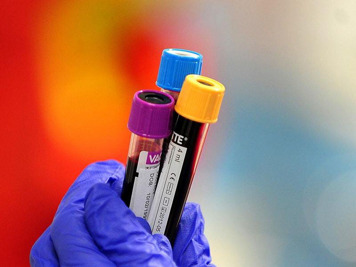 What Blood Test Can Detect Lung Cancer