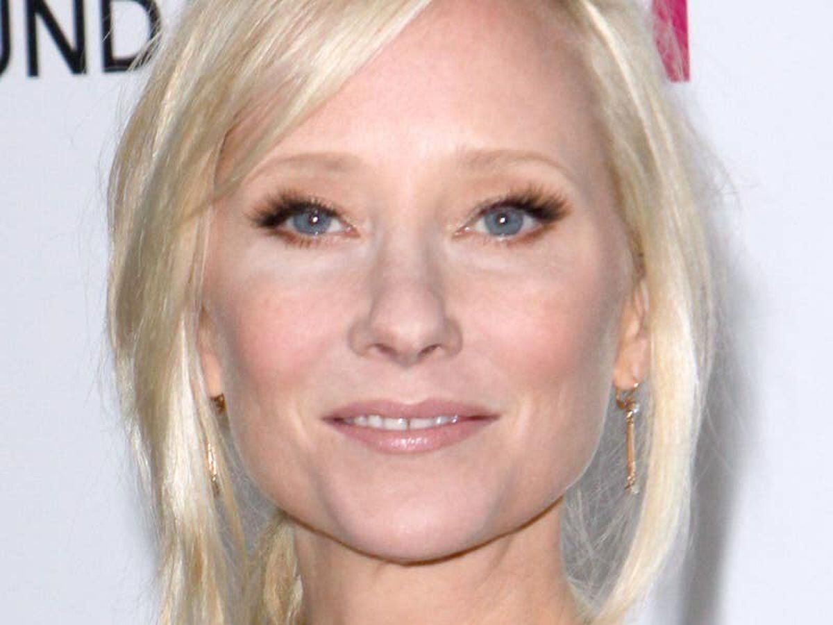 Anne Heche reportedly in critical condition following LA vehicle collision