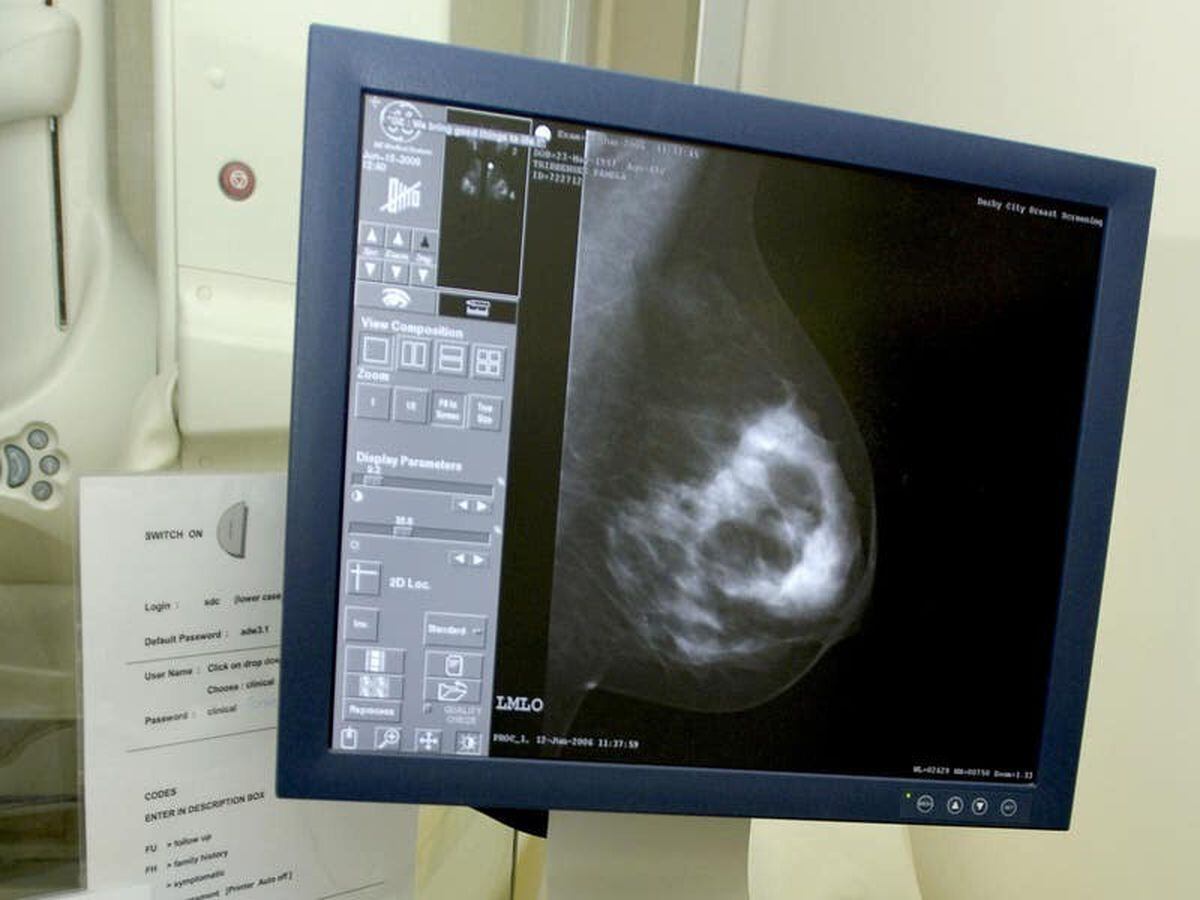 Breast cancer spreads at night, new research suggests