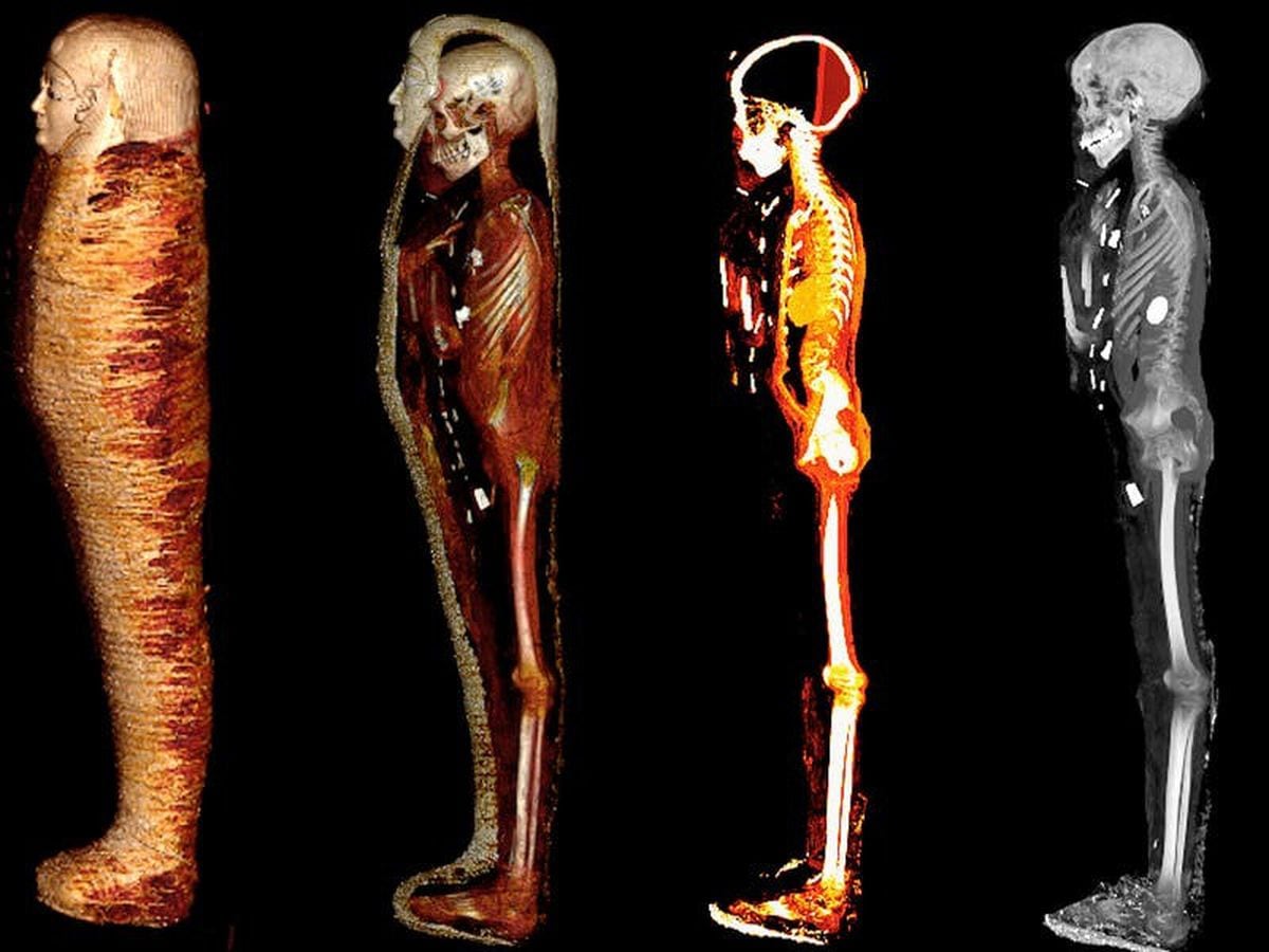Mummified ‘golden boy’ found with 49 amulets to speed journey to afterlife